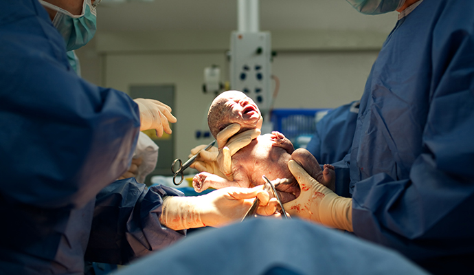 newborn baby from C-section